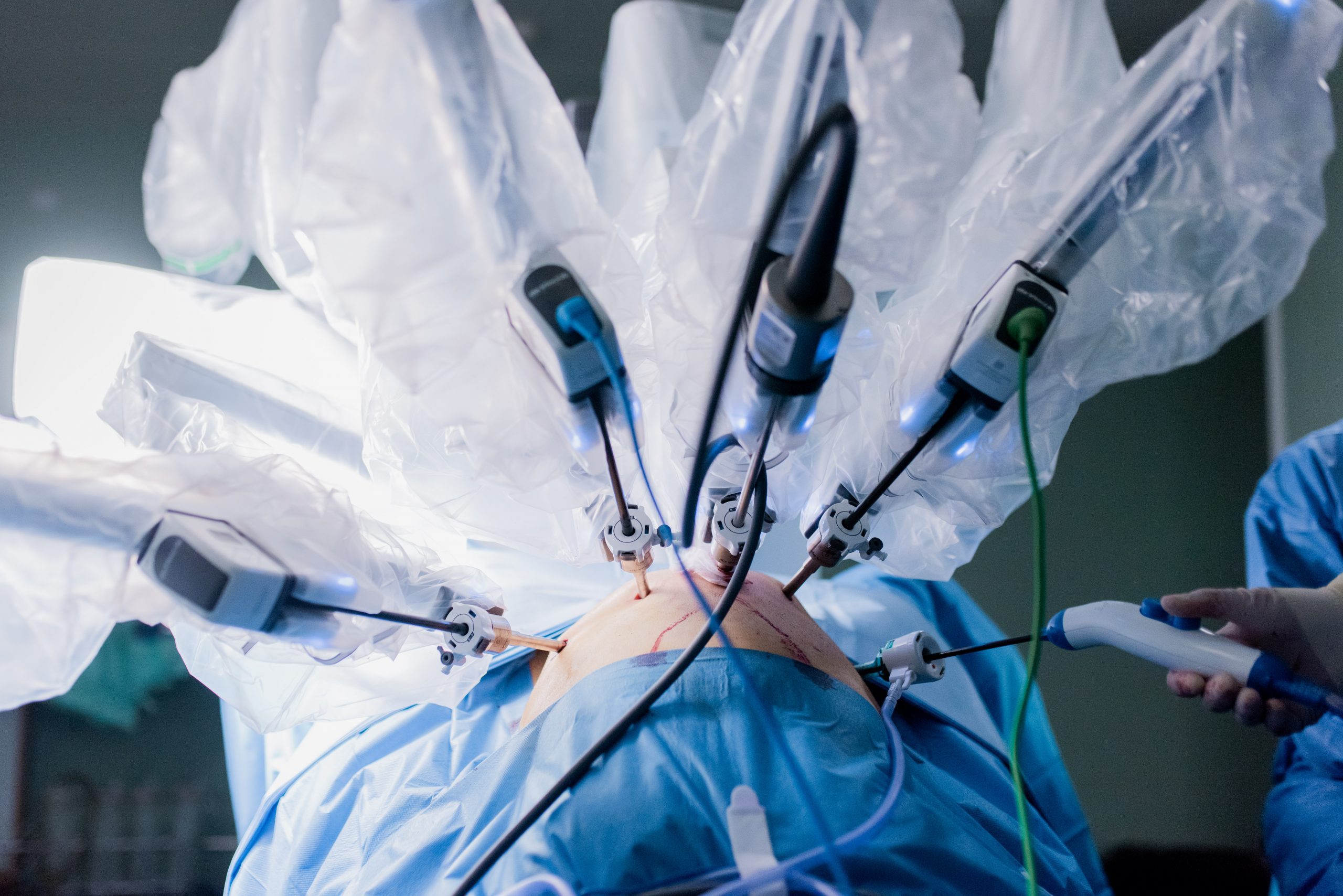 cirugia robotica cancer prostata valencia