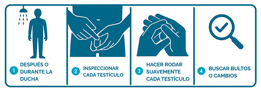 Autoexploración testicular paso a paso
